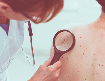 Pós-Graduação em Dermatologia